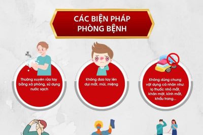 TUYÊN TRUYỀN DỊCH ĐAU MẮT ĐỎ